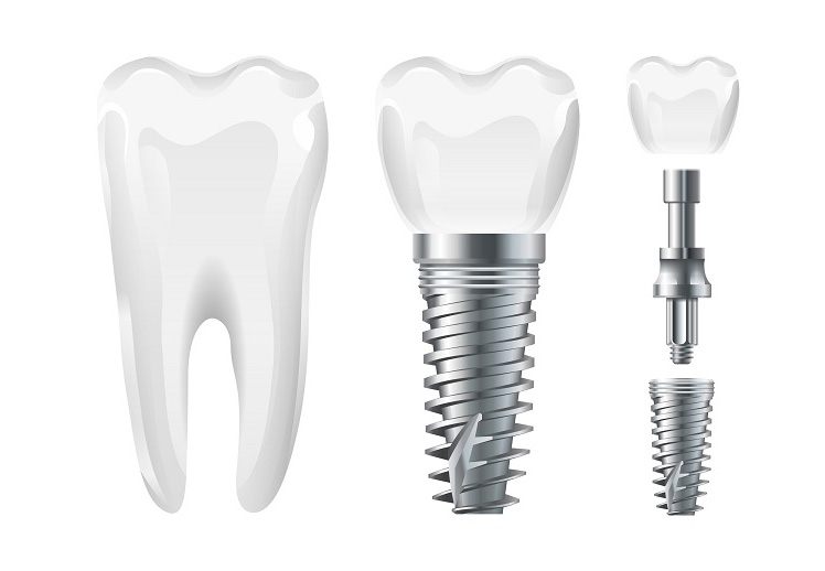 Future Dental Care Future Dental Care