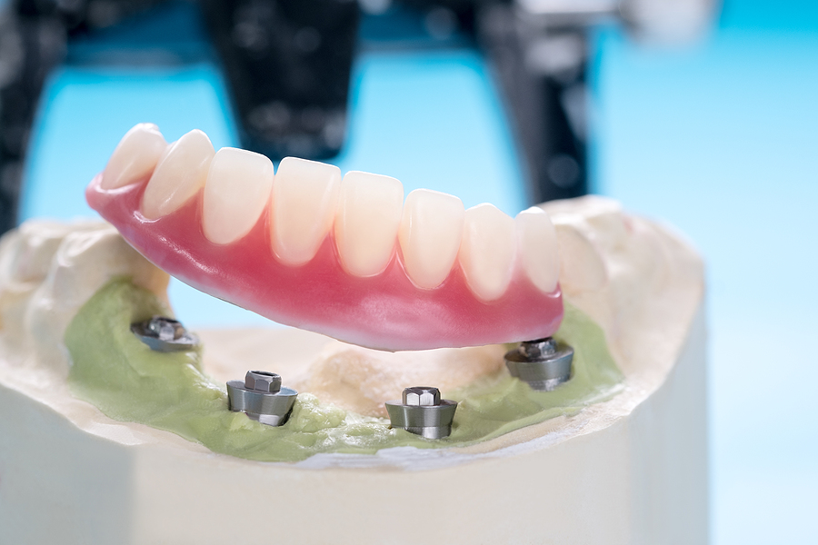 Future Dental Care Future Dental Care