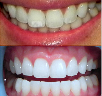 Future Dental Care Future Dental Care