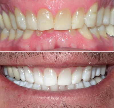 Future Dental Care Future Dental Care