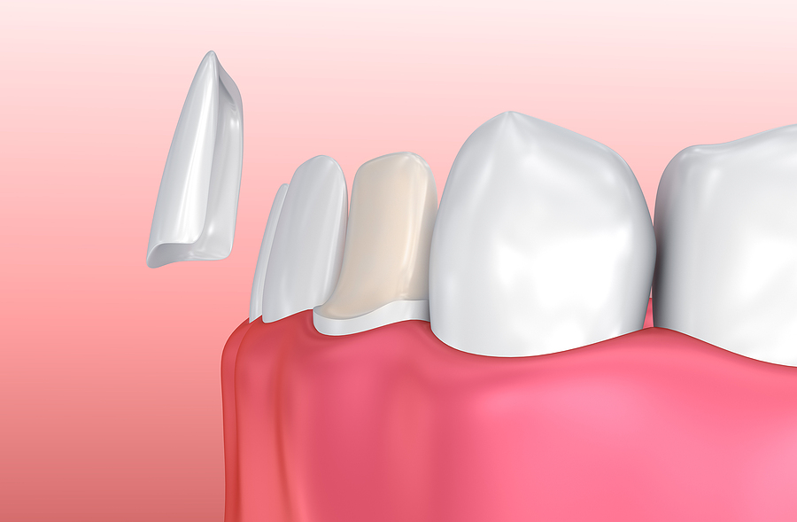 Future Dental Care Future Dental Care