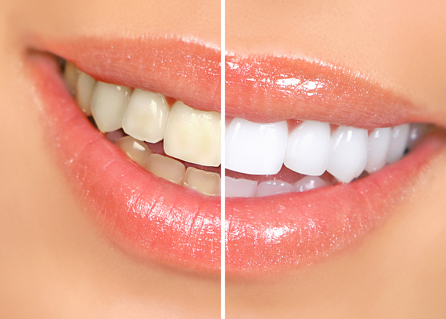 Future Dental Care Future Dental Care